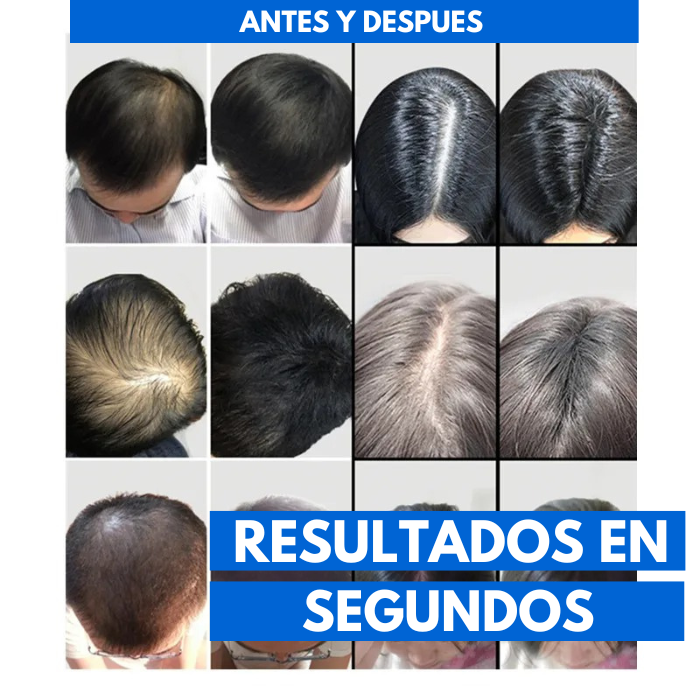 FIBRA CAPILAR + GUIA PARA REDUCIR PERDIDA DE CABELLO