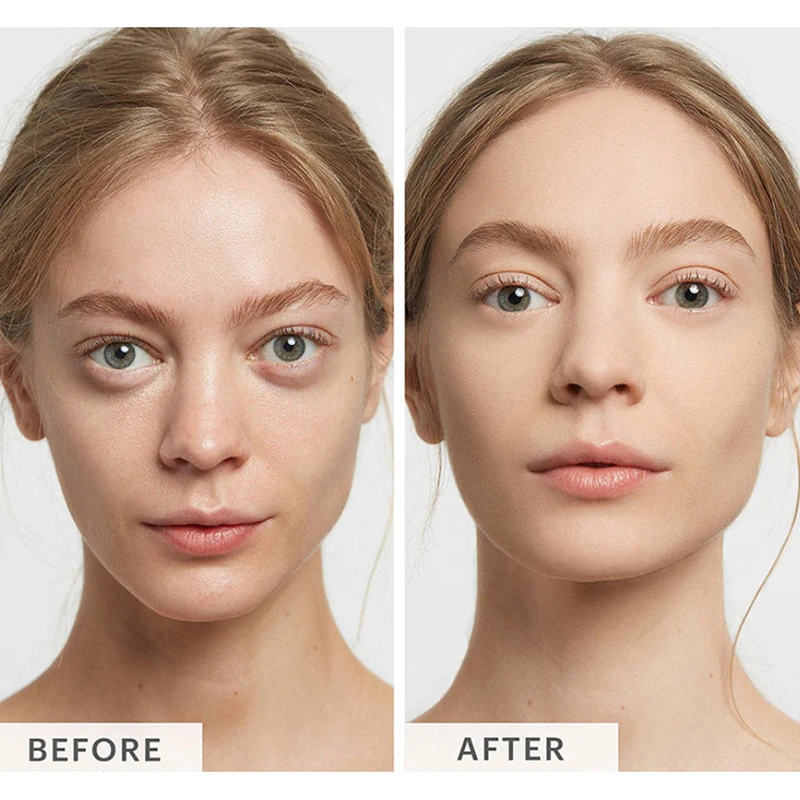 Kit de definición facial X2®