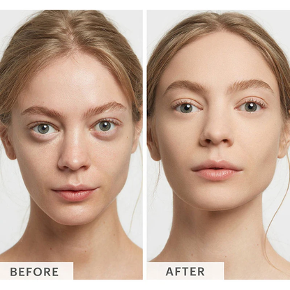 Kit de definición facial X2®